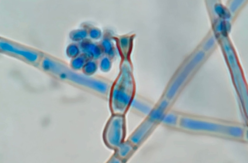 Investigador confirma presencia en Chile de hongo que provoca rara infección subcutánea