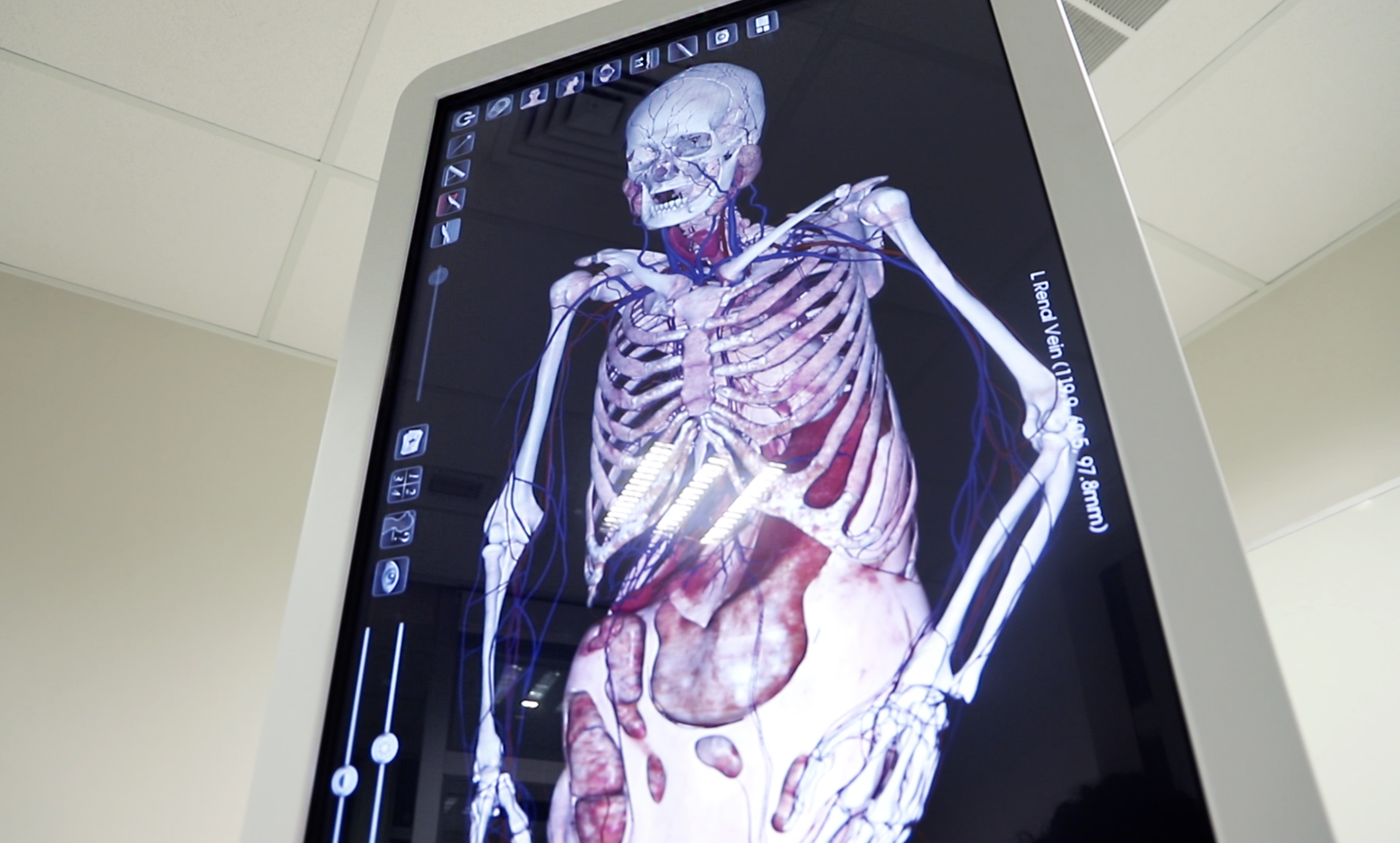 SALUD//Centro de Simulación Clínica de la Sede Temuco adquiere mesa de Anatomía de última generación