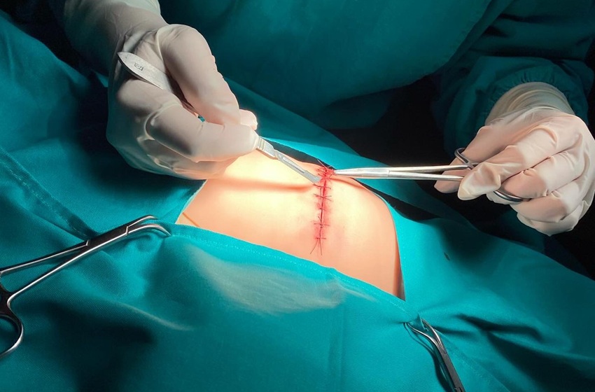 Centro de Simulación potencia habilidades clínicas en estudiantes a través del moulage