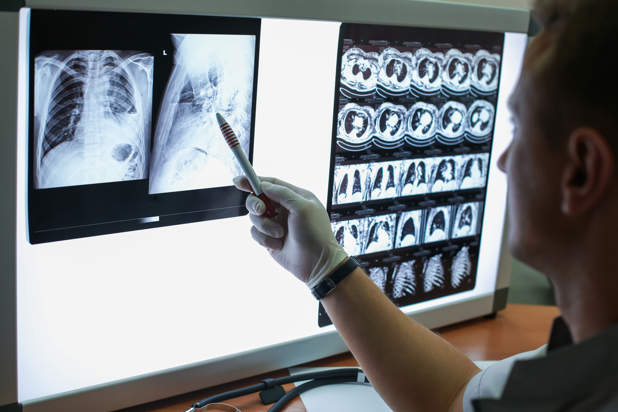 Postgrado// Tomografía Computarizada: la herramienta para combatir al Covid-19 y que resalta el rol de los tecnólogos médicos en la pandemia