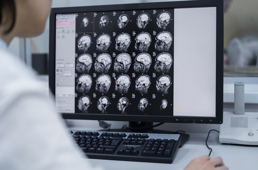 Especialidad de Neurología Adulto obtuvo la acreditación de la CNA por 3 años