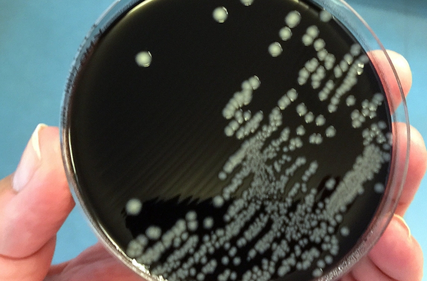 U. Mayor secuenciará el genoma de bacterias para apoyar la lucha mundial contra la resistencia a los antibióticos
