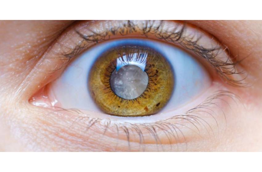 Científicos descifraron mecanismo genético involucrado en la formación de los ojos