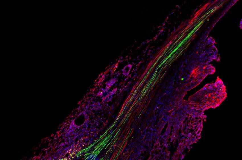 Descubren rol clave de células que impiden reparar daños al sistema nervioso periférico